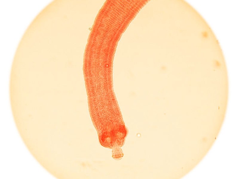 10. Trakavica - 700 smrtnih slučajeva godišnje