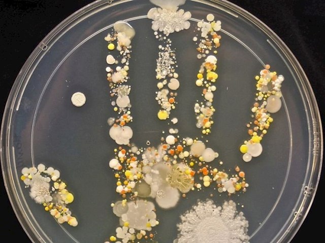 Otisak ruke osmogodišnjaka u Petrijevoj zdjelici