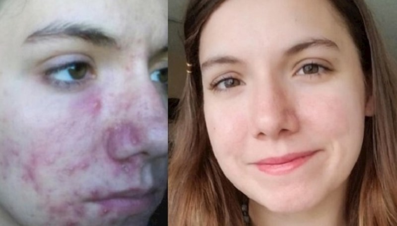 10 ljudi koji su bili dovoljno hrabri da promijene svoj život na bolje