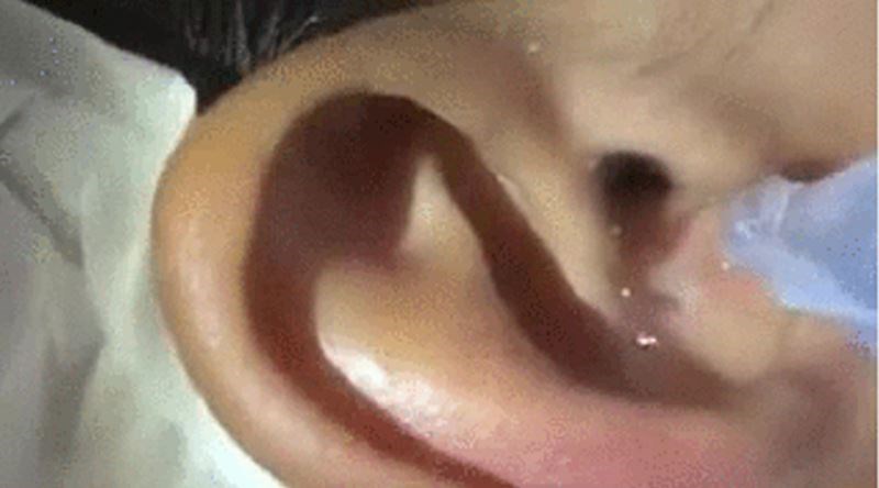 Ovaj lik ulio je vodu u uho, nećete vjerovati što je izašlo iznutra