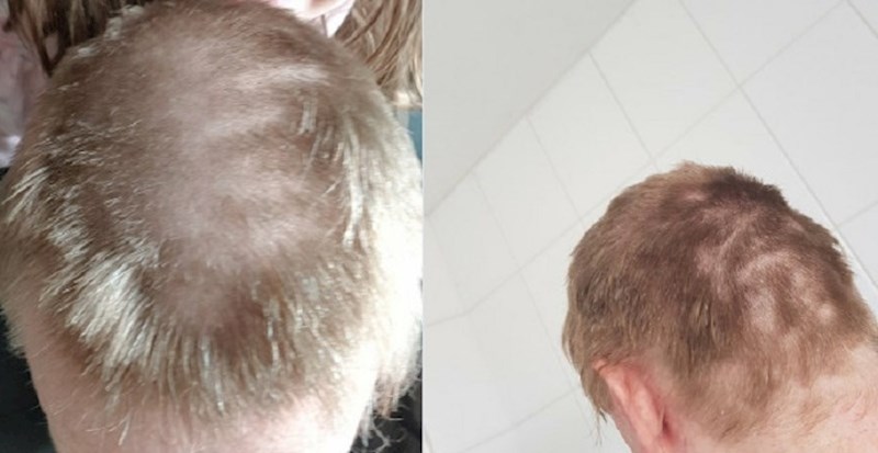 Ovi ljudi su pokušali glumiti frizere u karanteni, ali je to završilo jako loše