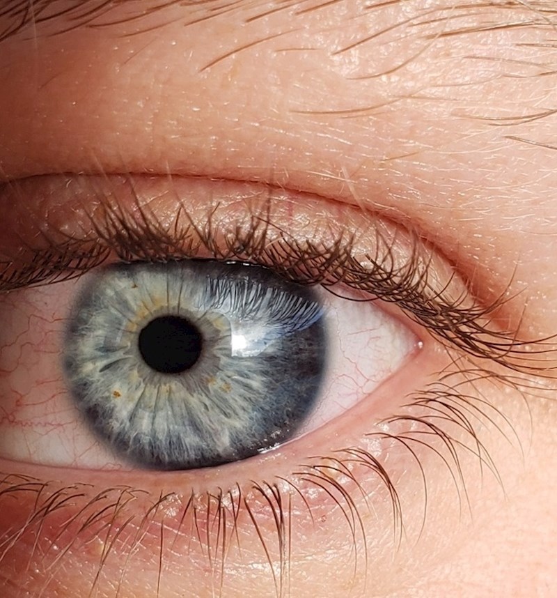 "Mom prijatelju zjenice nisu na sredini oka"