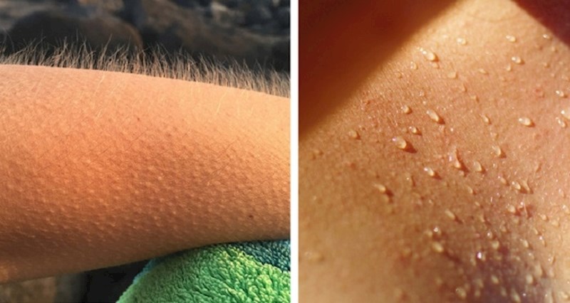 9 neobičnih činjenica o ljudskom tijelu koje će nas zadiviti, ali istovremeno i iznenaditi