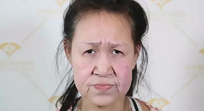 Tinejdžerica koja je izgledala kao baka dobila novo mlado lice