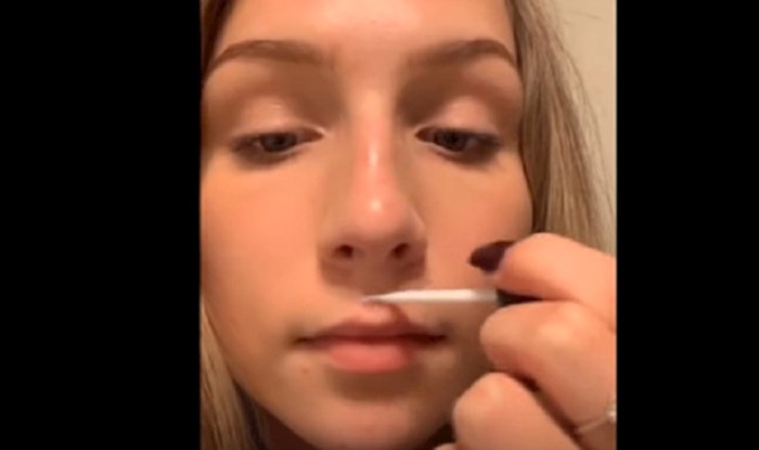 VIDEO Novi bizarni trend je povećanje usana ljepilom za trepavice, pogledajte kompilaciju ljudi koji su ga isprobali