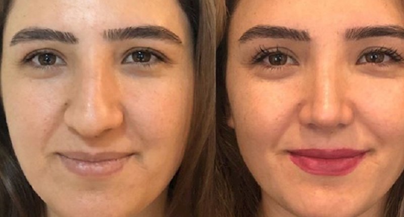 10 žena koje su promjenom sitnice na sebi dobile potpuno novi izgled