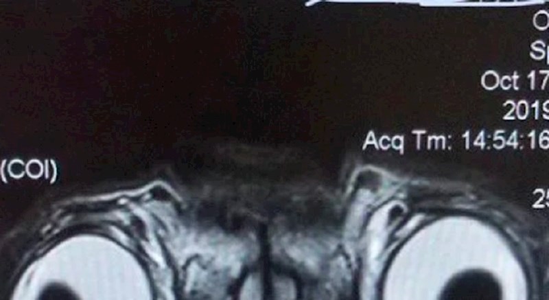 Ljudi na internetu se smiju ovoj zastrašujućoj magnetskoj rezonanciji mopsa