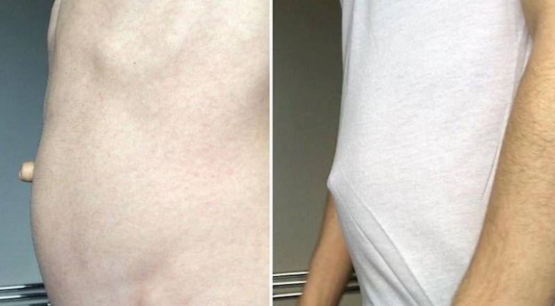 "Moj pupak strši kroz majicu"