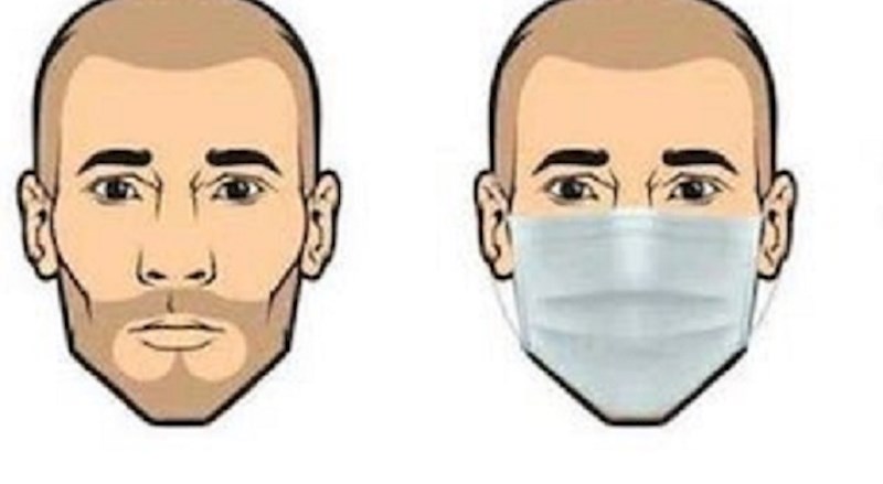 Ova fotka najbolje pokazuje koja će plastična operacija biti najpopularnija iduće godine