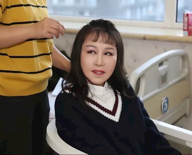Ravnatelj Shi rekao je da Xiao sada čekaju razni tretmani za daljnja poboljšanja izgleda i funkcije lica