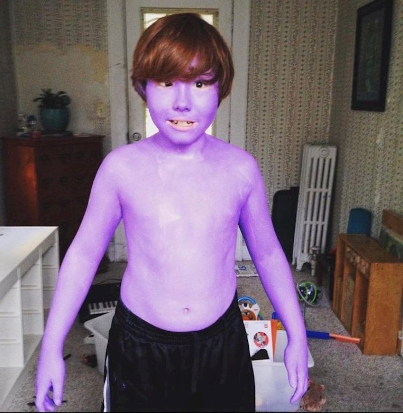 Sestra ga je obojala