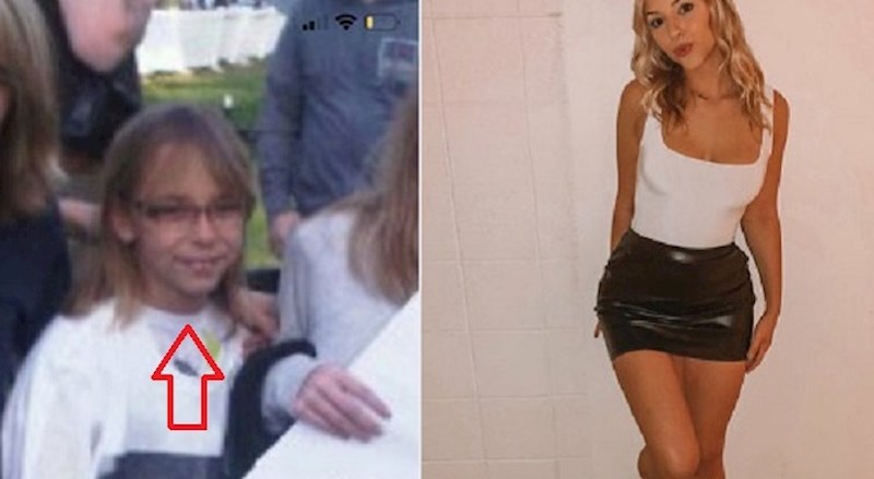 Ovi ljudi podijelili su slike sebe sada i s početka 2010-ih, promjene su nevjerojatne