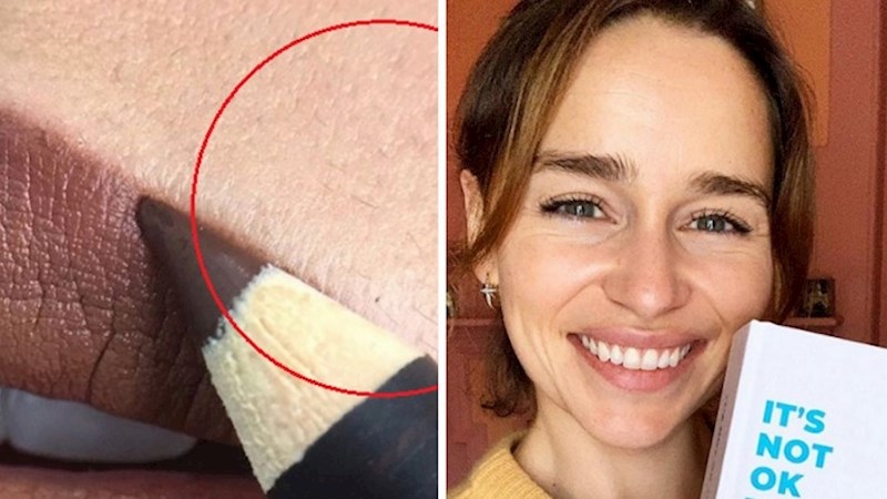 Neretuširane fotke koje su šokirale i iznenadile ljude na internetu, ali koje dokazuju da nitko od nas nije savršen