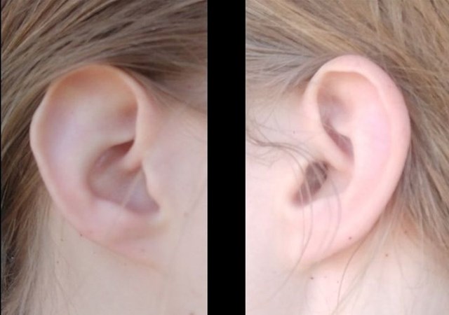 "Imam različite uši"