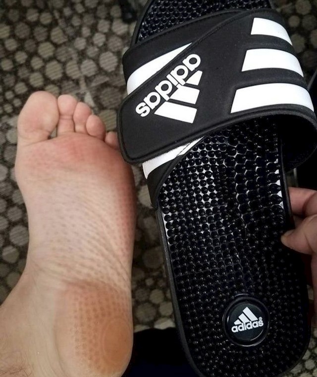Ovo je bolno