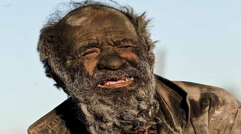 Ablutophobia - strah od kupanja i tuširanja