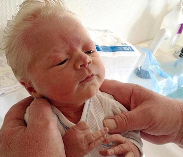 Beba rođena sa sijedom kosom