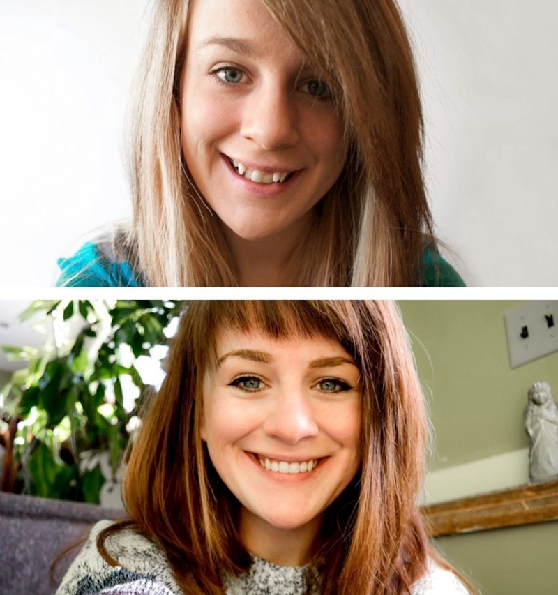 "Danas sam napokon skinula aparatić!"