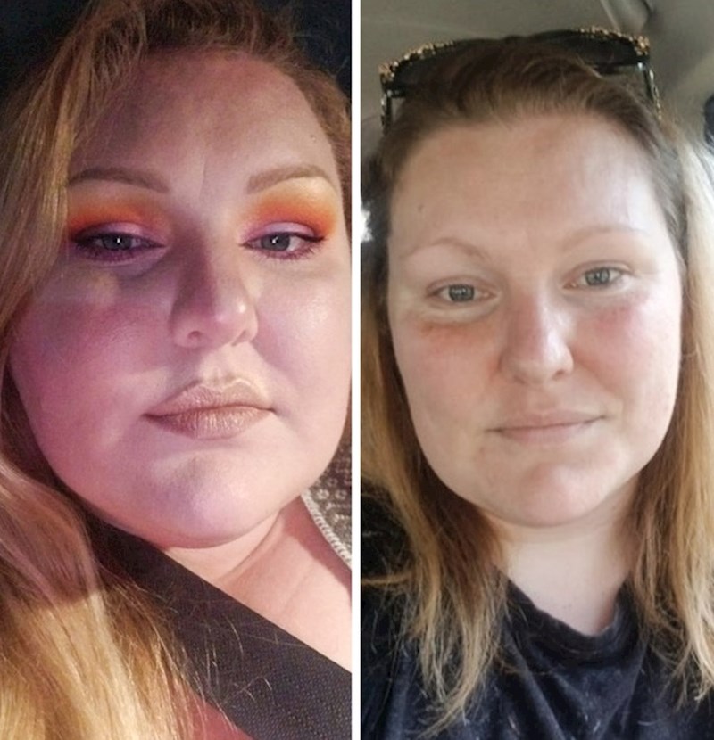 "Patila sam od depresije i gojaznosti cijeli život, ali sam odlučila uzeti stvari u svoje ruke"