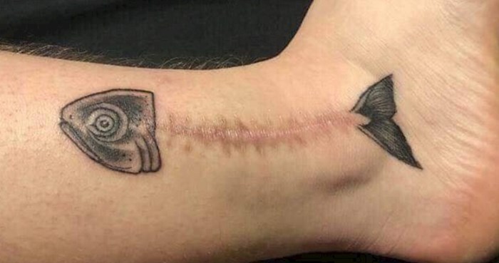 Ovi ljudi pretvorili su svoje ožiljke na koži u genijalne tetovaže