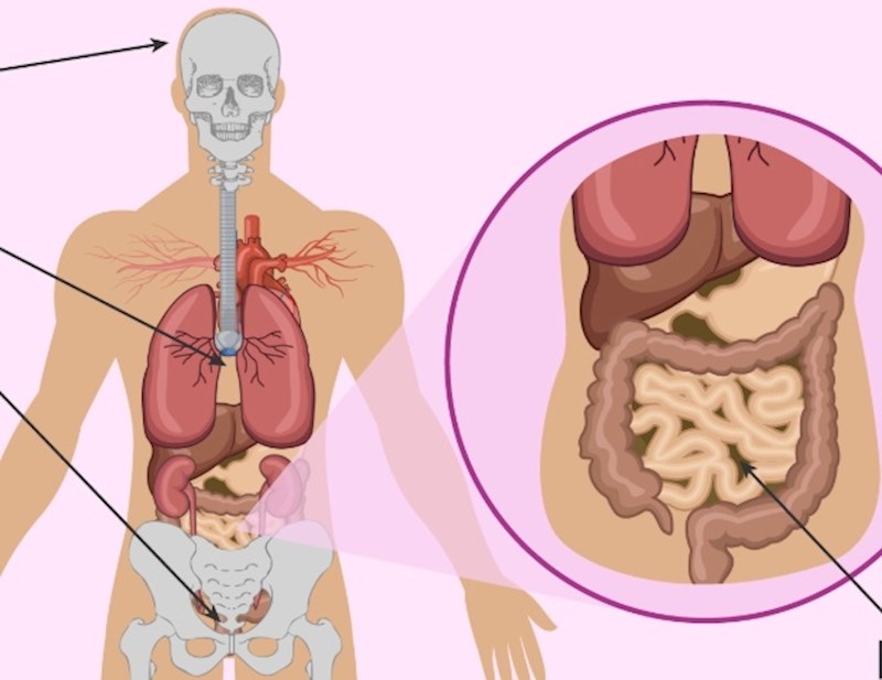 Postoje određene vrste tumora kojima mogu rasti vlastiti zubi i kosa