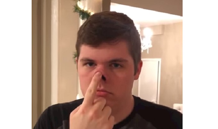 VIDEO Mladić ima neobično fleksibilan nos, ovako nešto niste vidjeli