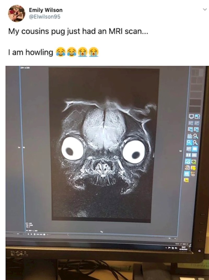 Ubrzo su i drugi počeli dijeliti slike svojih mopsova na magnetskoj rezonanciji