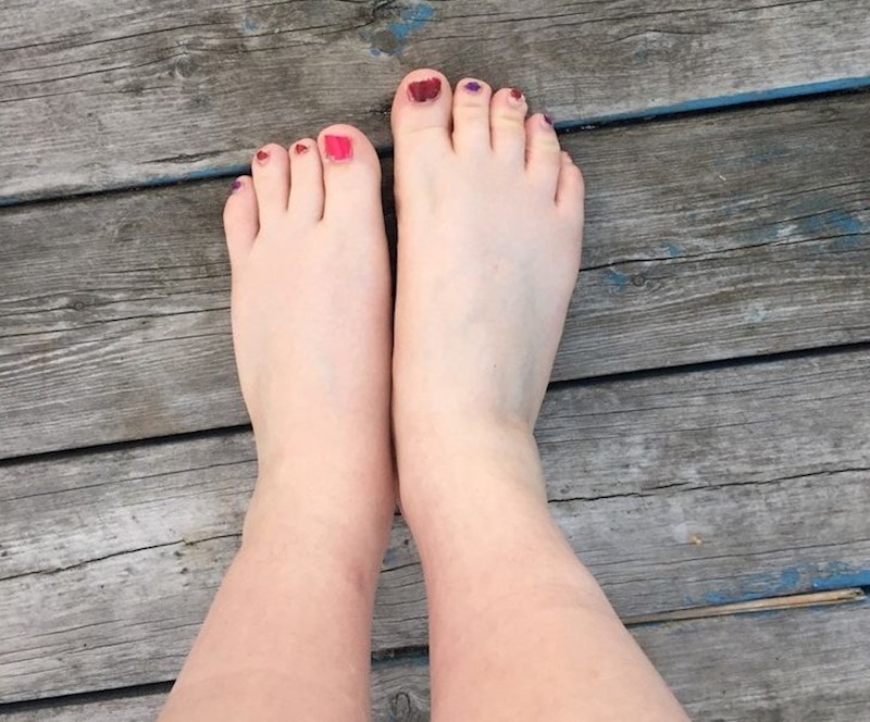 "Moja frendica ima samo 4 prsta na stopalu"