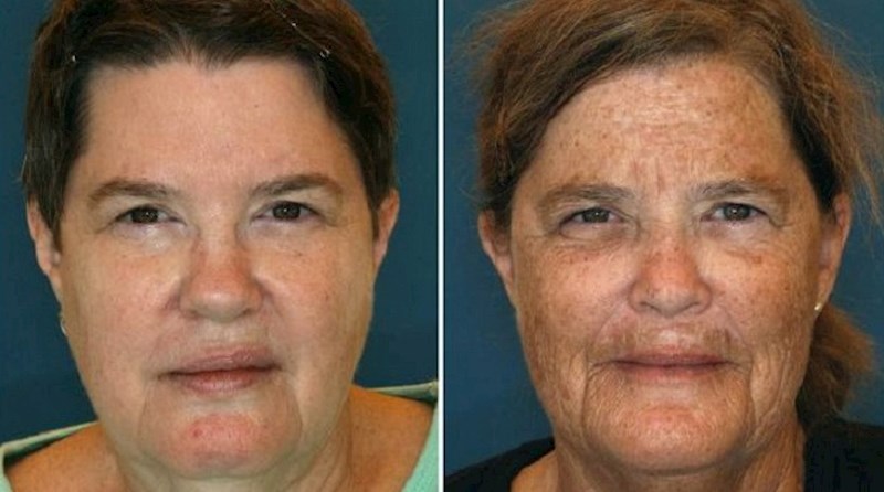 Nova doza fascinantnih i zanimljivih fotografija zbog kojih ćete se zamisliti