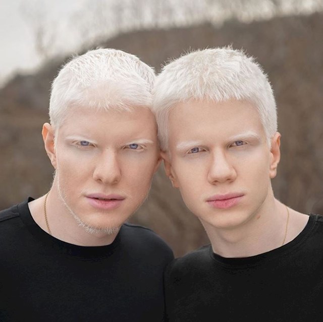 Jedinstveni blizanci