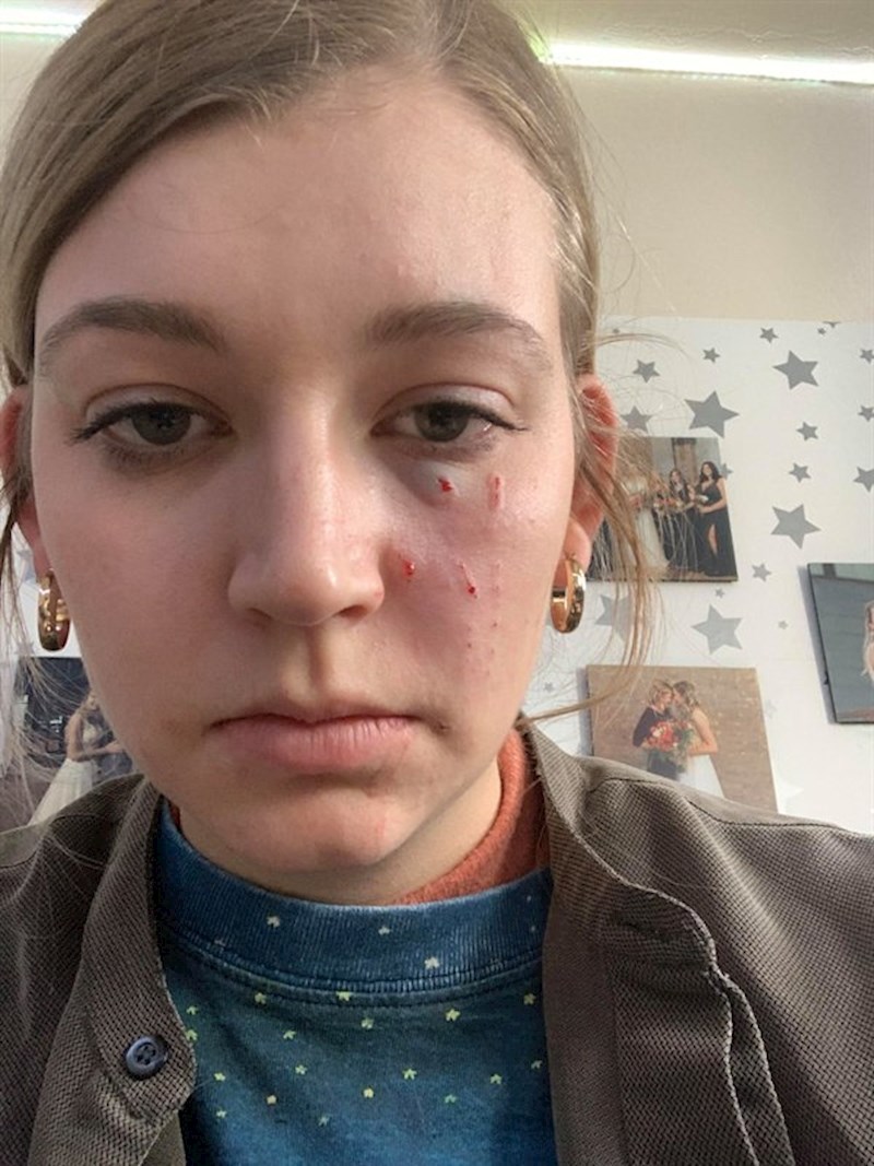 "Pouka dana: Ne podižite mačku kada je ljuta"