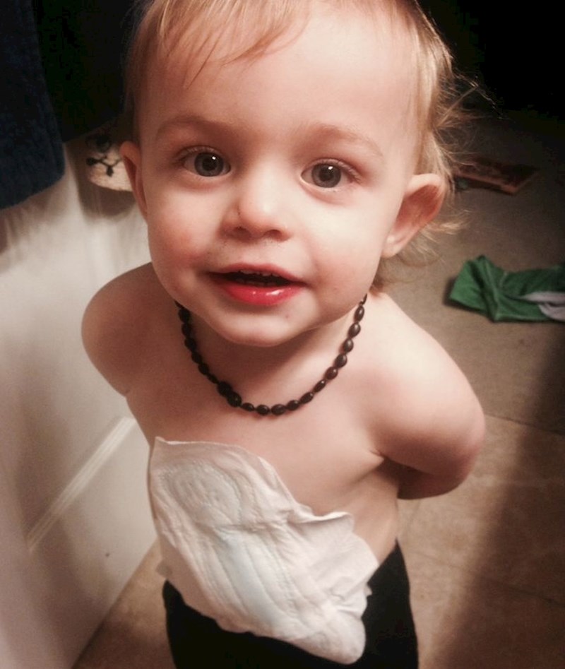 "Misli da je to flaster"