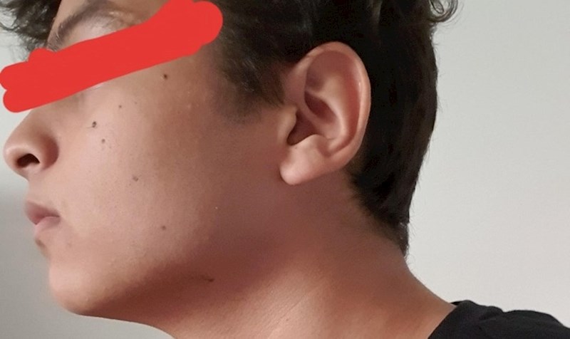 "Madeži na mome licu tvore broj 7"