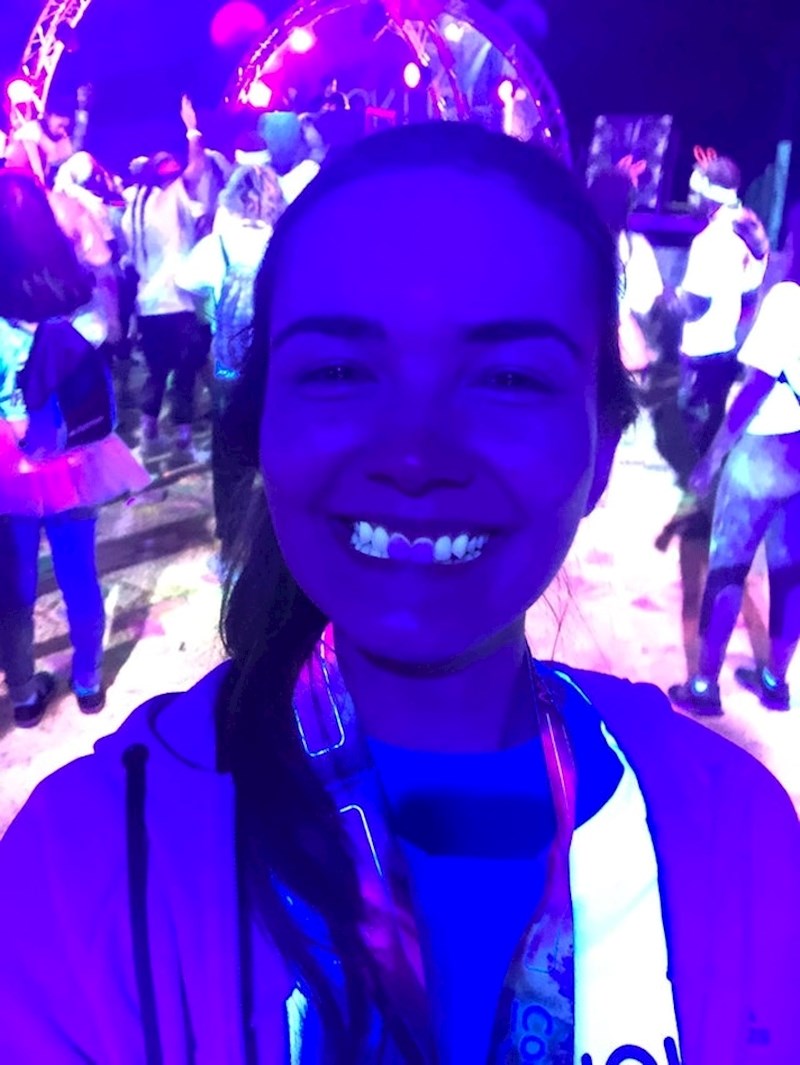 Ljuskice na zubima :)