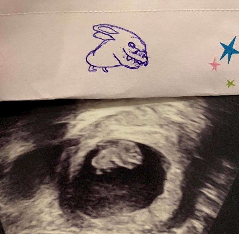 "Ne znam zašto ali moja sestra nije bila oduševljena mojim viđenjem njenog ultrazvuka."