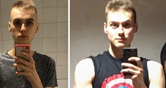 Od anoreksije mogu oboljeti i muškarci, pogledajte fotografije prije i nakon nevjerojatnog izlječenja