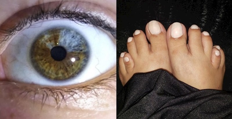 Ovi ljudi prihvatili su svoj nesvakidašnji izgledi i odlučili ga podijeliti s cijelim svijetom