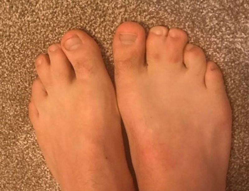 "Prsti na nogama mi rastu zajedno"