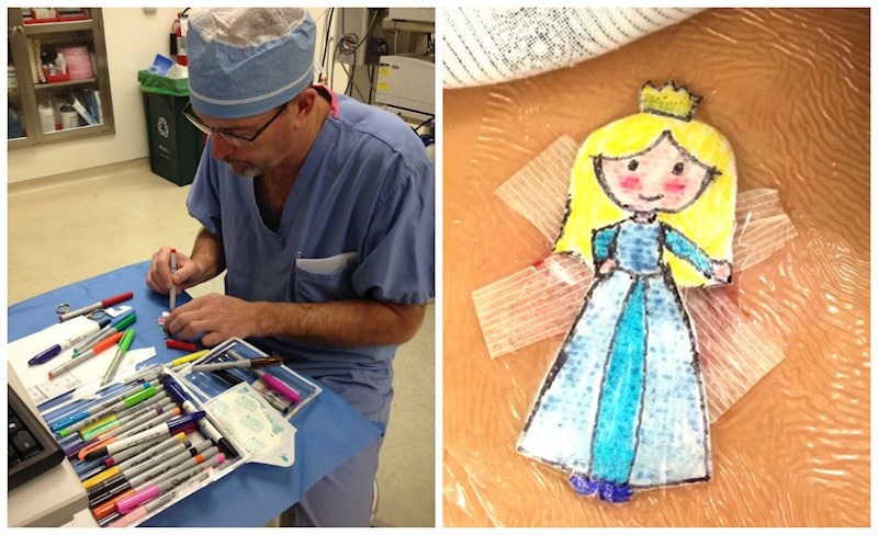 Kirurg prekriva dječje ožiljke likovima iz crtića kako bi im pomogao zaboraviti na bol