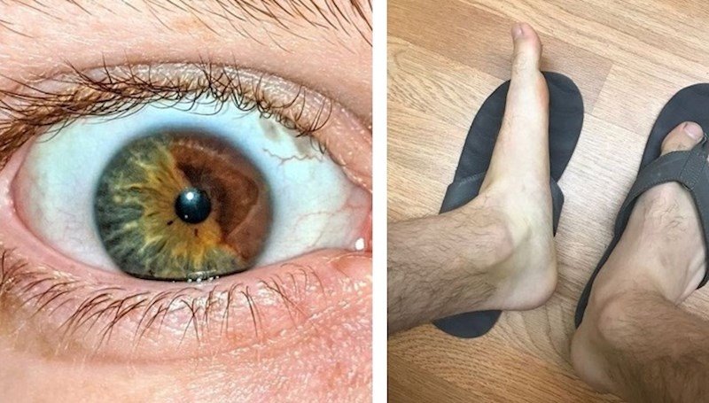 20 ljudi koji se ističu u masi zbog nečeg jedinstvenog na svom tijelu