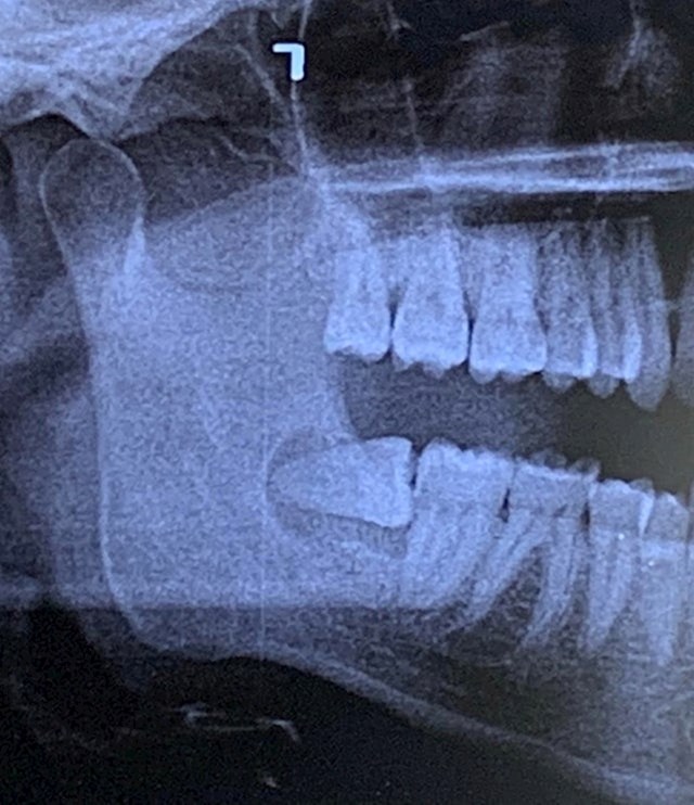 "Moj zubar mi je pokazao zašto me toliko bole zubi..."
