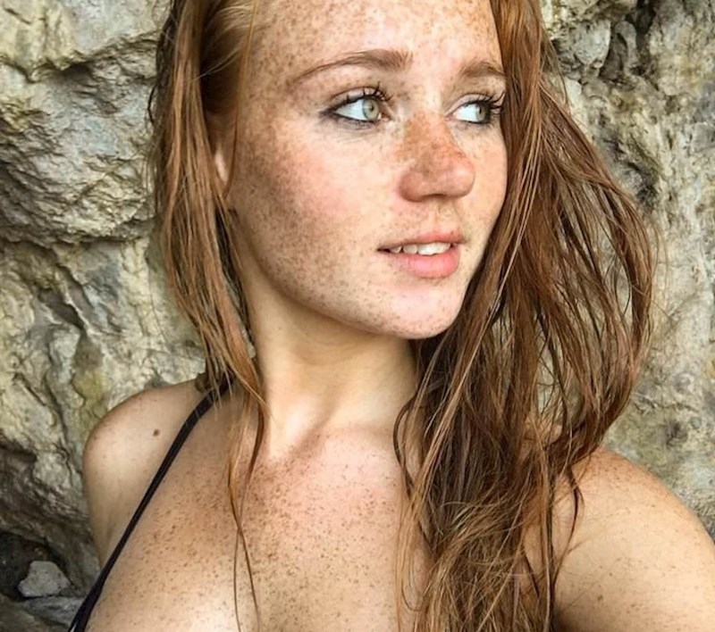 Pjegice na ovoj djevojci izgledaju predivno!