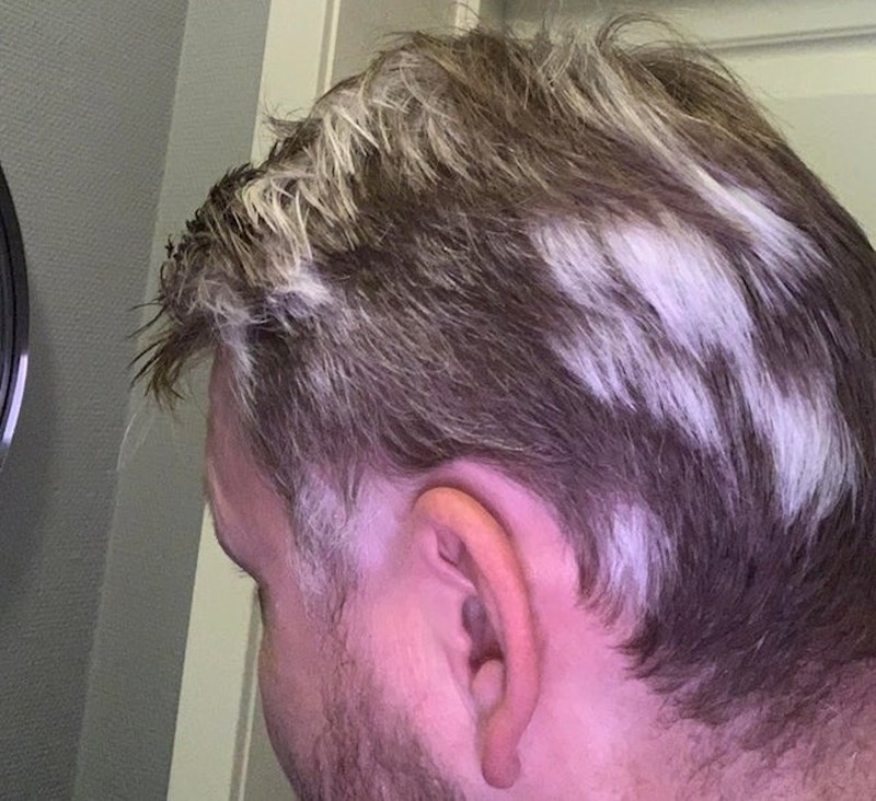 "Dobio sam ovo nakon nezgode na biciklu prije par godina"