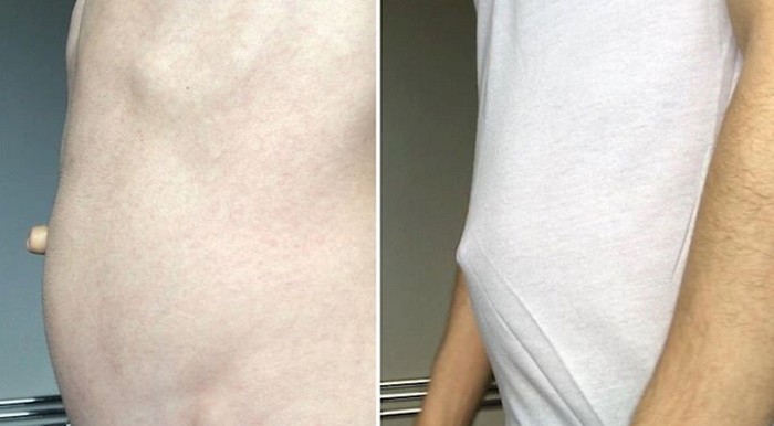 15 ljudi koji se od rođenja ističu u masi