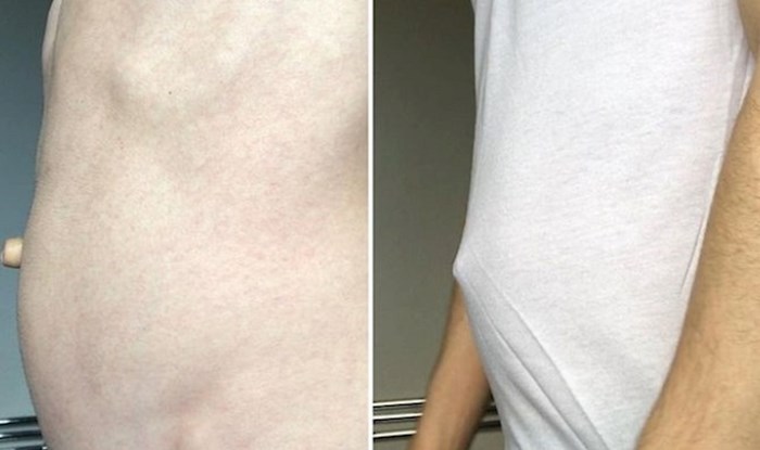 15 ljudi koji se od rođenja ističu u masi