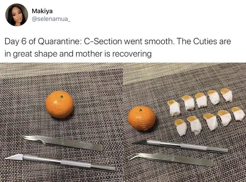 Šesti dan karantene: Carski rez je prošao odlično. Bebice su zdrave, a mama se uspješno oporavlja