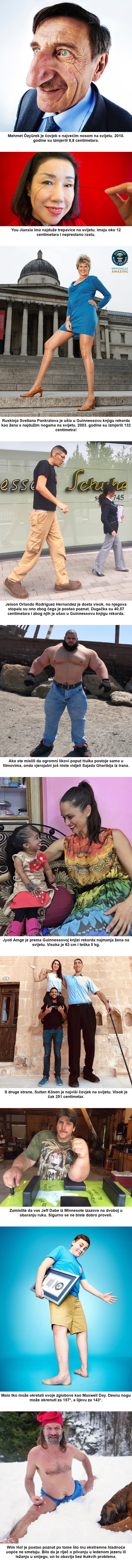 10 čudesnih ljudi koji izgledaju kao da su prekršili zakone ljudske genetike