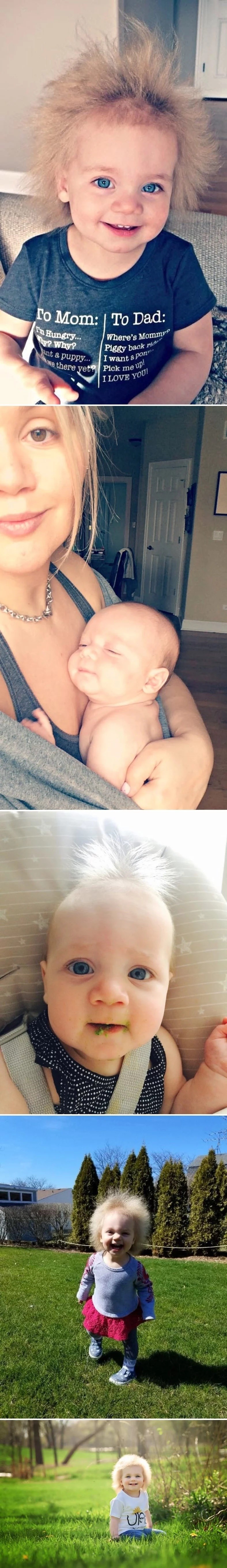 Izgledala je kao obična beba, a onda su roditelji počeli primjećivati nešto vrlo čudno i rijetko na njoj