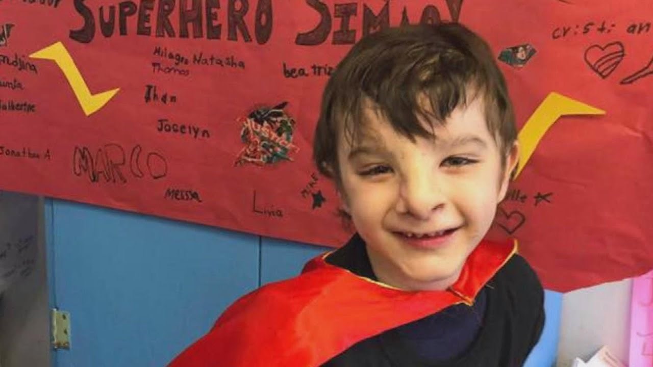 Djeca su vrijeđala dječaka zbog rijetkog poremećaja, estetski kirurg mu je vratio samopouzdanje