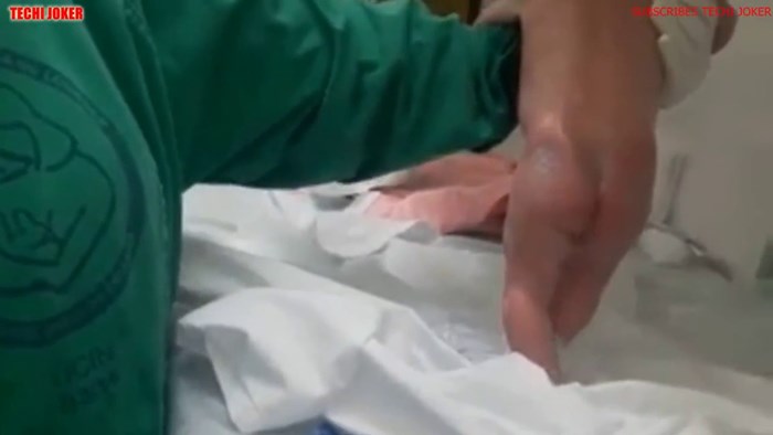 Beba "prohodala" odmah nakon rođenja! Doktori su snimili nevjerojatnu snimku koja je začudila svijet